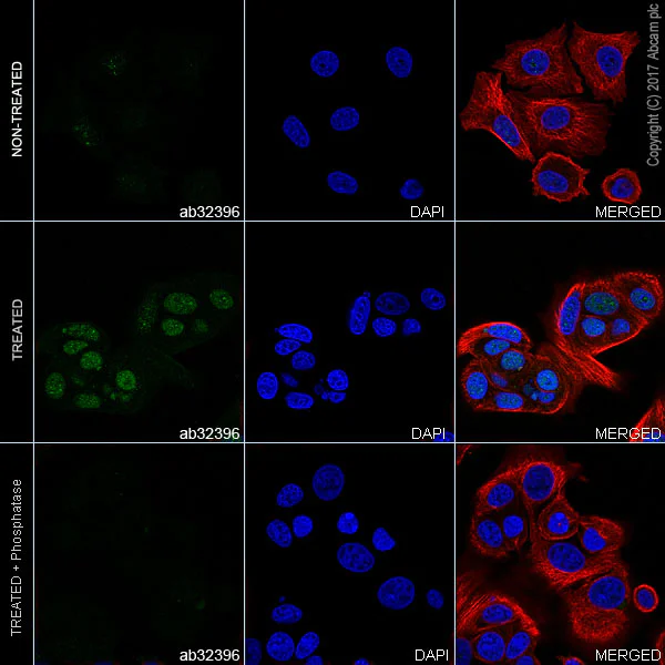 Immunocytochemistry/ Immunofluorescence - Anti-Estrogen Receptor alpha (phospho S118) antibody [E91] - BSA and Azide free (AB177817)