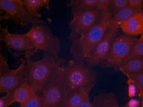 Immunocytochemistry/ Immunofluorescence - Anti-Estrogen Receptor alpha (phospho S167) antibody (AB131105), expandable thumbnail