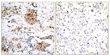 Immunohistochemistry (Formalin/PFA-fixed paraffin-embedded sections) - Anti-Estrogen Receptor alpha (phospho S167) antibody (AB131105), expandable thumbnail