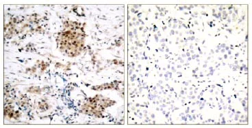 Immunohistochemistry (Formalin/PFA-fixed paraffin-embedded sections) - Anti-Estrogen Receptor alpha (phospho S167) antibody (AB131105)
