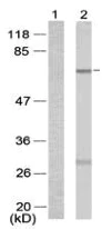 Western blot - Anti-Estrogen Receptor alpha (phospho S167) antibody (AB131105)
