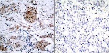Immunohistochemistry (Formalin/PFA-fixed paraffin-embedded sections) - Anti-Estrogen Receptor alpha (phospho S167) antibody (AB31478)