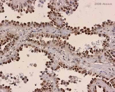Immunohistochemistry (Formalin/PFA-fixed paraffin-embedded sections) - Anti-Estrogen Receptor alpha (phospho S167) antibody (AB31478)