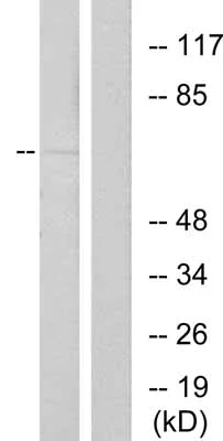 Western blot - Anti-Estrogen Receptor alpha (phospho S167) antibody (AB31478)