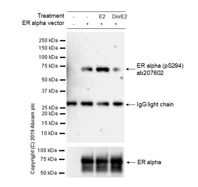 Western blot - Anti-Estrogen Receptor alpha (phospho S294) antibody [BUI-1-37] (AB207602)
