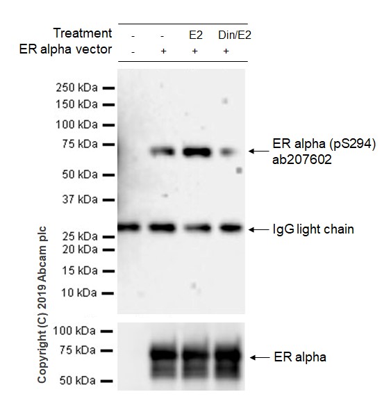 Western blot - Anti-Estrogen Receptor alpha (phospho S294) antibody [BUI-1-37] - BSA and Azide free (AB242439), expandable thumbnail