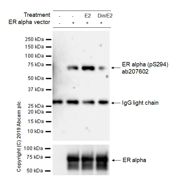 Western blot - Anti-Estrogen Receptor alpha (phospho S294) antibody [BUI-1-37] - BSA and Azide free (AB242439)