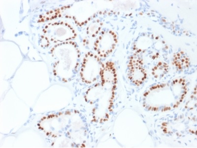Immunohistochemistry (Formalin/PFA-fixed paraffin-embedded sections) - Anti-Estrogen Receptor antibody [ESR1/1935] (AB237995), expandable thumbnail