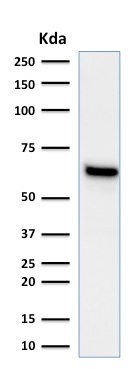 Western blot - Anti-Estrogen Receptor antibody [ESR1/1935] (AB237995), expandable thumbnail
