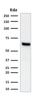 Western blot - Anti-Estrogen Receptor antibody [ESR1/1935] (AB237995)