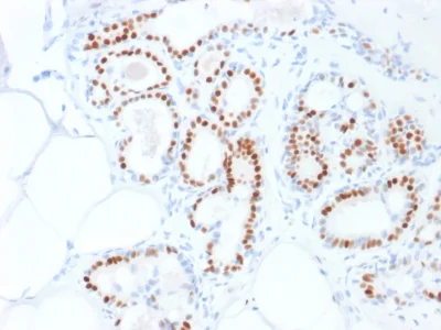 Immunohistochemistry (Formalin/PFA-fixed paraffin-embedded sections) - Anti-Estrogen Receptor antibody [ESR1/1935] - BSA and Azide free (AB237837)