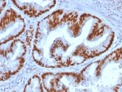 Immunohistochemistry (Formalin/PFA-fixed paraffin-embedded sections) - Anti-Estrogen Receptor antibody [ESR1/1935] - BSA and Azide free (AB237837)