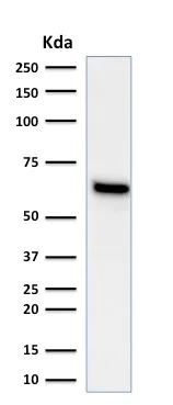 Western blot - Anti-Estrogen Receptor antibody [ESR1/1935] - BSA and Azide free (AB237837)