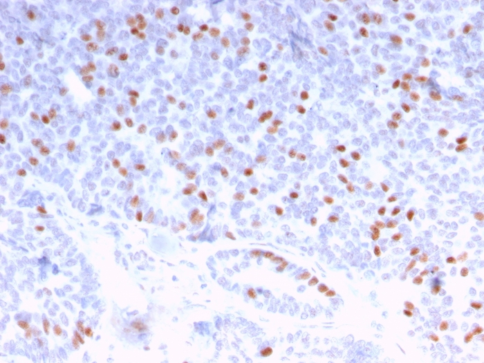 Immunohistochemistry (Formalin/PFA-fixed paraffin-embedded sections) - Anti-Estrogen Receptor antibody [ESR1/3373] - BSA and Azide free (AB268175)