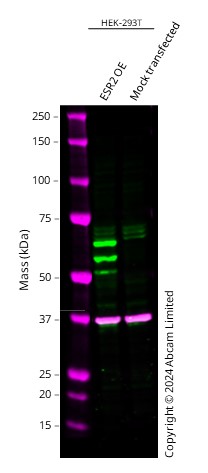 Western blot - Anti-Estrogen Receptor beta 1 antibody [ERb455] - C-terminal (AB187291), expandable thumbnail