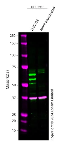 Western blot - Anti-Estrogen Receptor beta 1 antibody [ERb455] - C-terminal (AB187291)