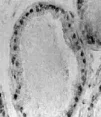 Immunohistochemistry (Formalin/PFA-fixed paraffin-embedded sections) - Anti-Estrogen Receptor beta antibody (AB5786)