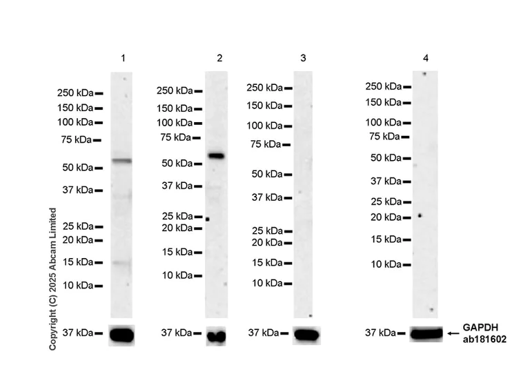 Western blot - Anti-Estrogen receptor beta antibody [EPR27876-74] (AB323621)