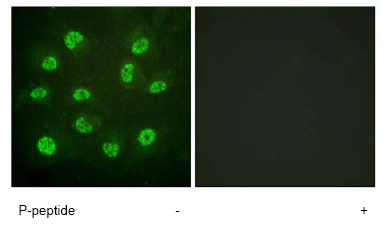 Immunocytochemistry/ Immunofluorescence - Anti-Estrogen Receptor beta (phospho S105) antibody (AB62257)