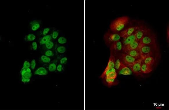 Immunocytochemistry/ Immunofluorescence - Anti-Estrogen Related Receptor alpha antibody (AB137489)