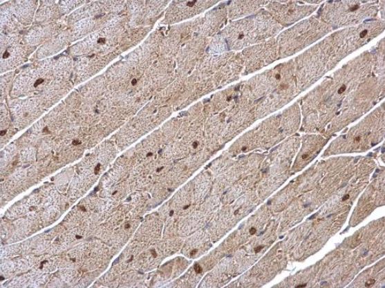 Immunohistochemistry (Formalin/PFA-fixed paraffin-embedded sections) - Anti-Estrogen Related Receptor alpha antibody (AB137489), expandable thumbnail