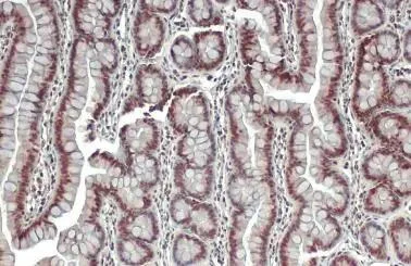 Immunohistochemistry (Formalin/PFA-fixed paraffin-embedded sections) - Anti-Estrogen Related Receptor alpha antibody (AB137489)
