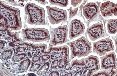 Immunohistochemistry (Formalin/PFA-fixed paraffin-embedded sections) - Anti-Estrogen Related Receptor alpha antibody (AB137489)