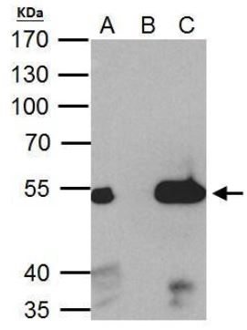 Immunoprecipitation - Anti-Estrogen Related Receptor alpha antibody (AB137489), expandable thumbnail