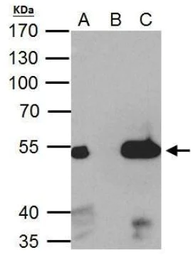 Immunoprecipitation - Anti-Estrogen Related Receptor alpha antibody (AB137489)