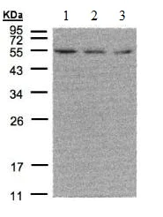 Western blot - Anti-Estrogen Related Receptor alpha antibody (AB137489)
