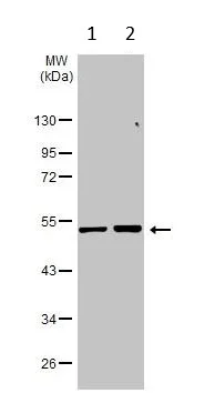 Western blot - Anti-Estrogen Related Receptor alpha antibody (AB137489)