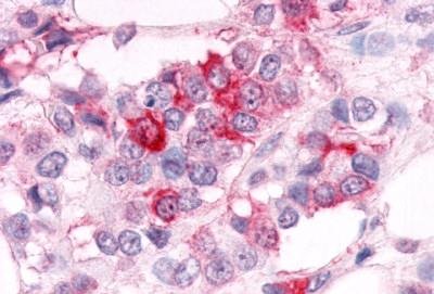 Immunohistochemistry (Formalin/PFA-fixed paraffin-embedded sections) - Anti-Estrogen Related Receptor alpha antibody (AB150560)