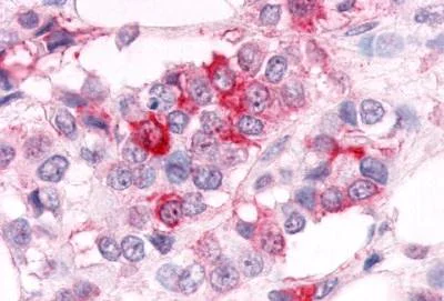 Immunohistochemistry (Formalin/PFA-fixed paraffin-embedded sections) - Anti-Estrogen Related Receptor alpha antibody (AB150560)