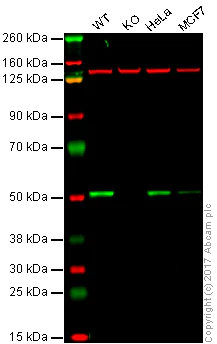 Western blot - Anti-Estrogen Related Receptor alpha antibody [EPR46Y] (AB76228)