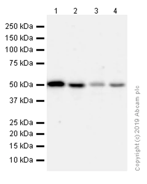 Western blot - Anti-Estrogen Related Receptor alpha antibody [EPR46Y] (AB76228)