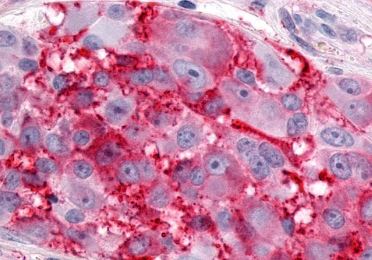 Immunohistochemistry (Formalin/PFA-fixed paraffin-embedded sections) - Anti-Estrogen Related Receptor gamma antibody - C-terminal (AB219547)