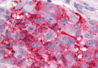 Immunohistochemistry (Formalin/PFA-fixed paraffin-embedded sections) - Anti-Estrogen Related Receptor gamma antibody - C-terminal (AB219547)