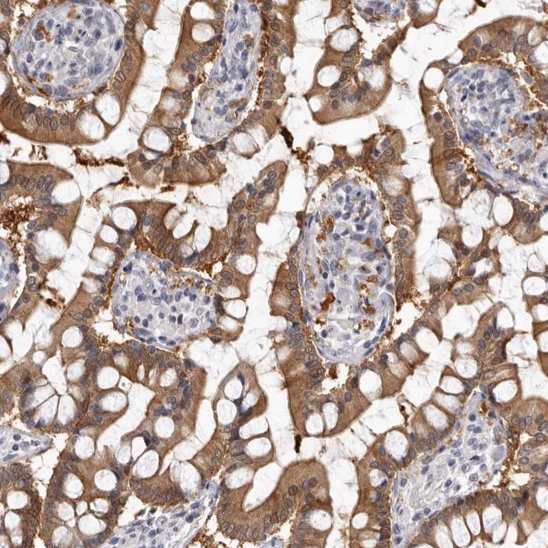 Immunohistochemistry (Formalin/PFA-fixed paraffin-embedded sections) - Anti-Estrogen Sulfotransferase antibody (AB224761)