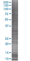 Estrogen Sulfotransferase overexpression 293T lysate (whole cell)