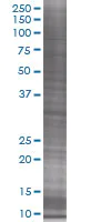 SDS-PAGE - Estrogen Sulfotransferase overexpression 293T lysate (whole cell) (AB94288)