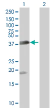 Western blot - Estrogen Sulfotransferase overexpression 293T lysate (whole cell) (AB94288)