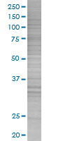 Estrogen Sulfotransferase overexpression 293T lysate (whole cell)
