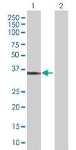 Western blot - Estrogen Sulfotransferase overexpression 293T lysate (whole cell) (AB94289)