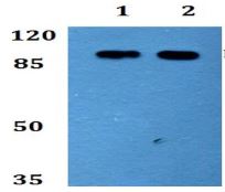 Western blot - Anti-ETAA1 antibody (AB192402), expandable thumbnail