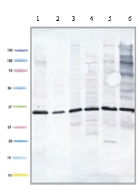 Western blot - Anti-ETFA antibody [2B11AE8] (AB110316)