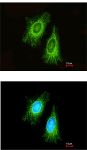 Immunocytochemistry/ Immunofluorescence - Anti-ETFA antibody (ab153722), expandable thumbnail