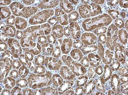 Immunohistochemistry (Formalin/PFA-fixed paraffin-embedded sections) - Anti-ETFA antibody (AB153722)
