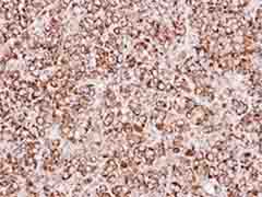 Immunohistochemistry (Formalin/PFA-fixed paraffin-embedded sections) - Anti-ETFA antibody (ab153722), expandable thumbnail