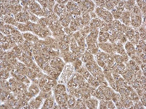 Immunohistochemistry (Formalin/PFA-fixed paraffin-embedded sections) - Anti-ETFA antibody (AB153722)