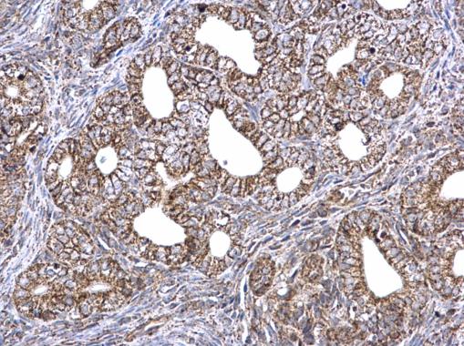 Immunohistochemistry (Formalin/PFA-fixed paraffin-embedded sections) - Anti-ETFA antibody (ab153722), expandable thumbnail
